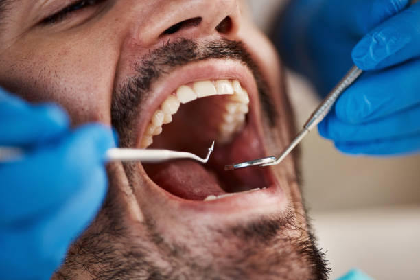 Best Broken Tooth Emergency  in Somerset, OH