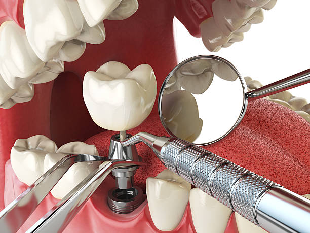 Best Urgent Tooth Repair  in Somerset, OH
